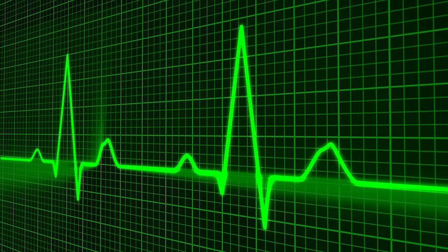 Symptome einer Aortenstenose werden mittels Ultraschall untersucht - das Bild zeit die Herzfrequenzmessung.